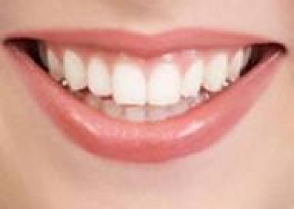 هل هناك علاقة بين أنواع الغذاء وأمراض الفم والأسنان؟