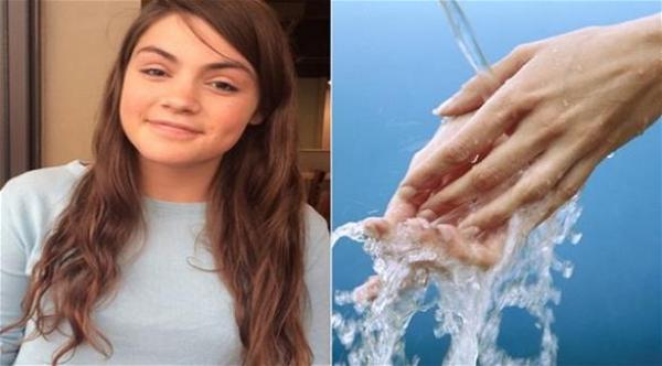 فتاة تغسل يديها 50 مرة في اليوم لأنها تخشى الأوساخ