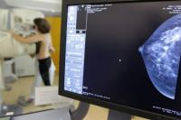 طبيب باحث يكشف معطيات خطيرة عن سرطان الثدي بالمغرب ويبسط سبل الوقاية منه