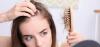 احذريها :هذه 6 أدوية تسبب تساقط الشعر والعلاجات المقترحة